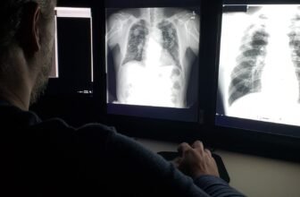 Lung Energy Peaks in Our 20s—and It is a Regular Decline From There, Examine Finds